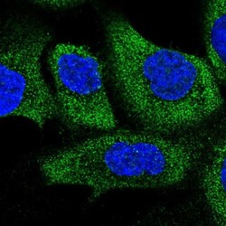 COQ10B Antibody, Novus Biologicals:Antibodies:Primary Antibodies